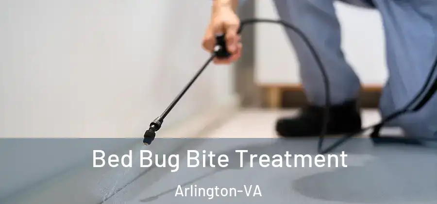 Bed Bug Bite Treatment Arlington-VA